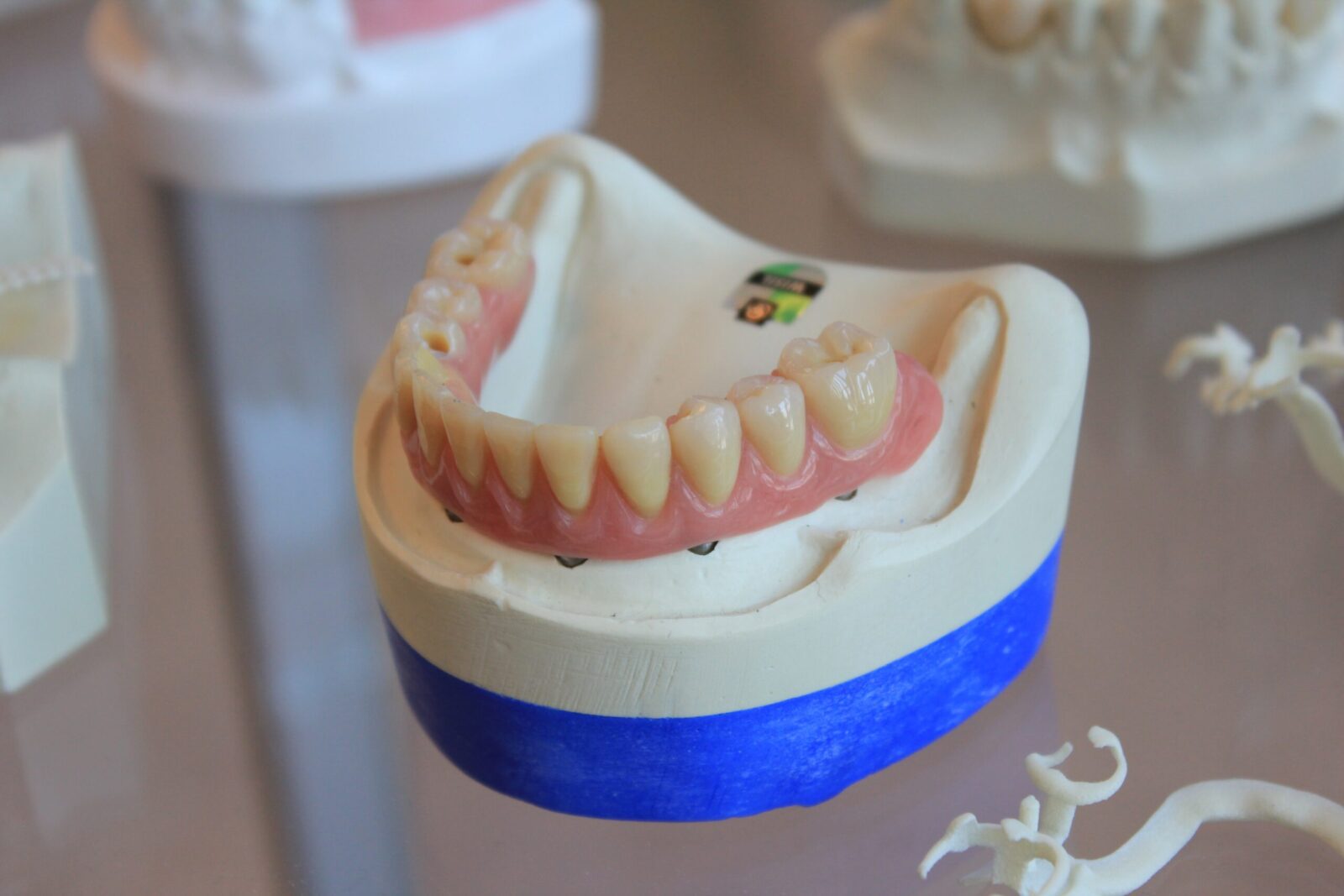 Гнатология в стоматологии: что это такое и когда нужно обратиться в гнатологу
