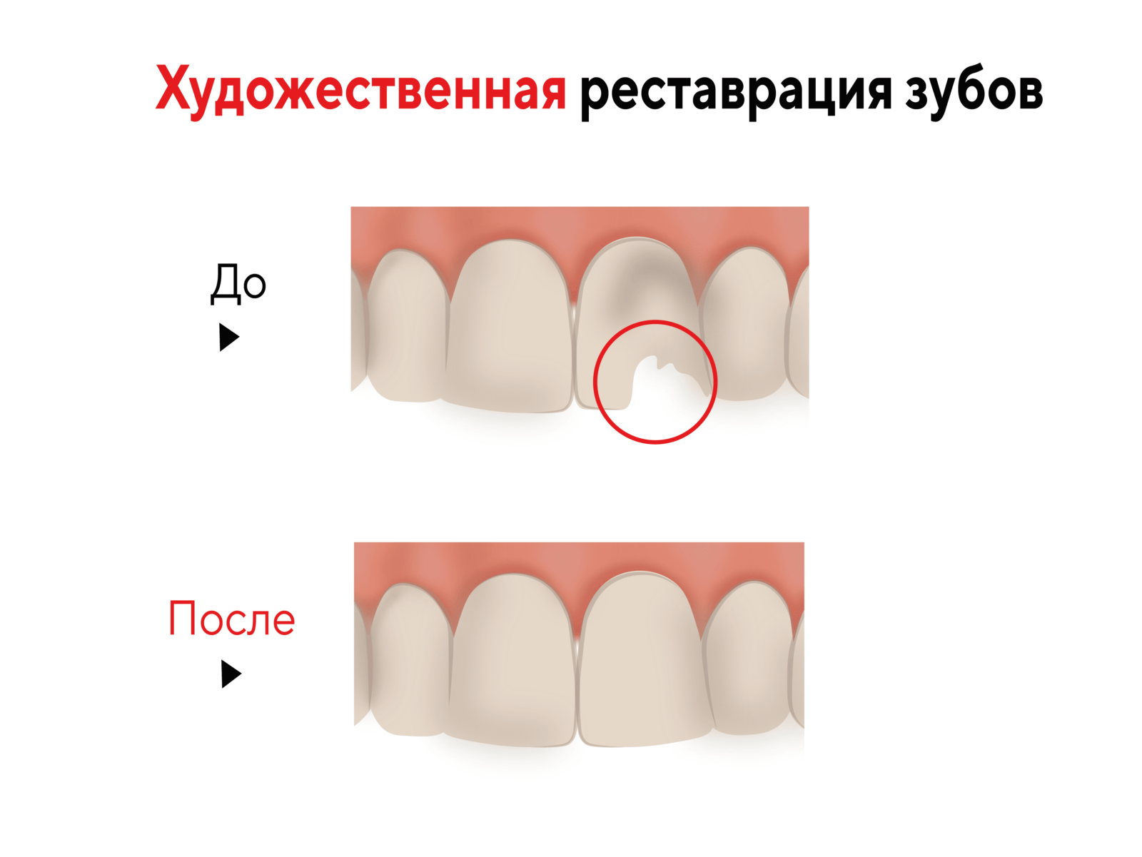 Художественная реставрация зубов в Москве